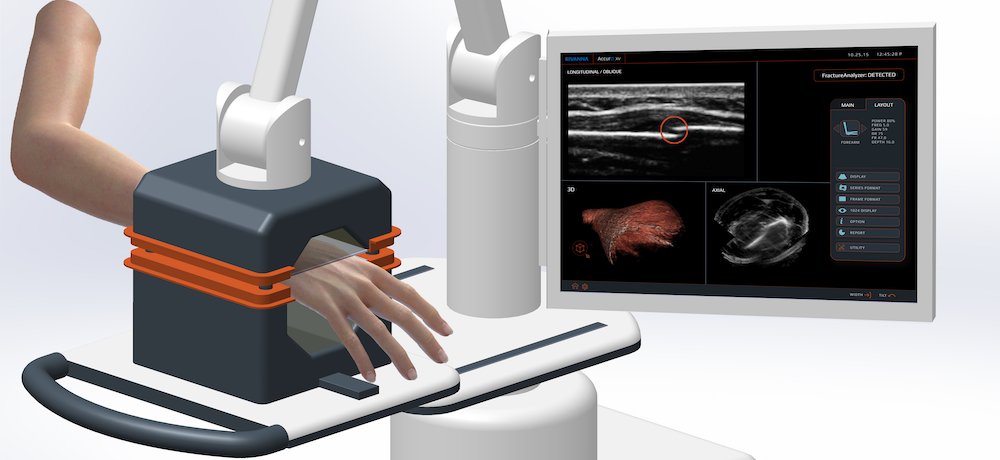 ARM-view-screen