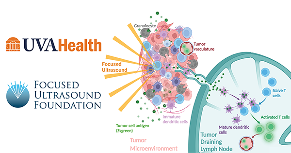UVA Health, Focused Ultrasound Foundation Partner to Create World’s First Focused Ultrasound Cancer Immunotherapy Center